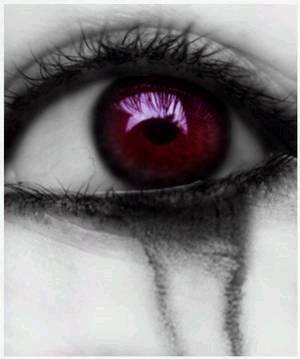douleur !!